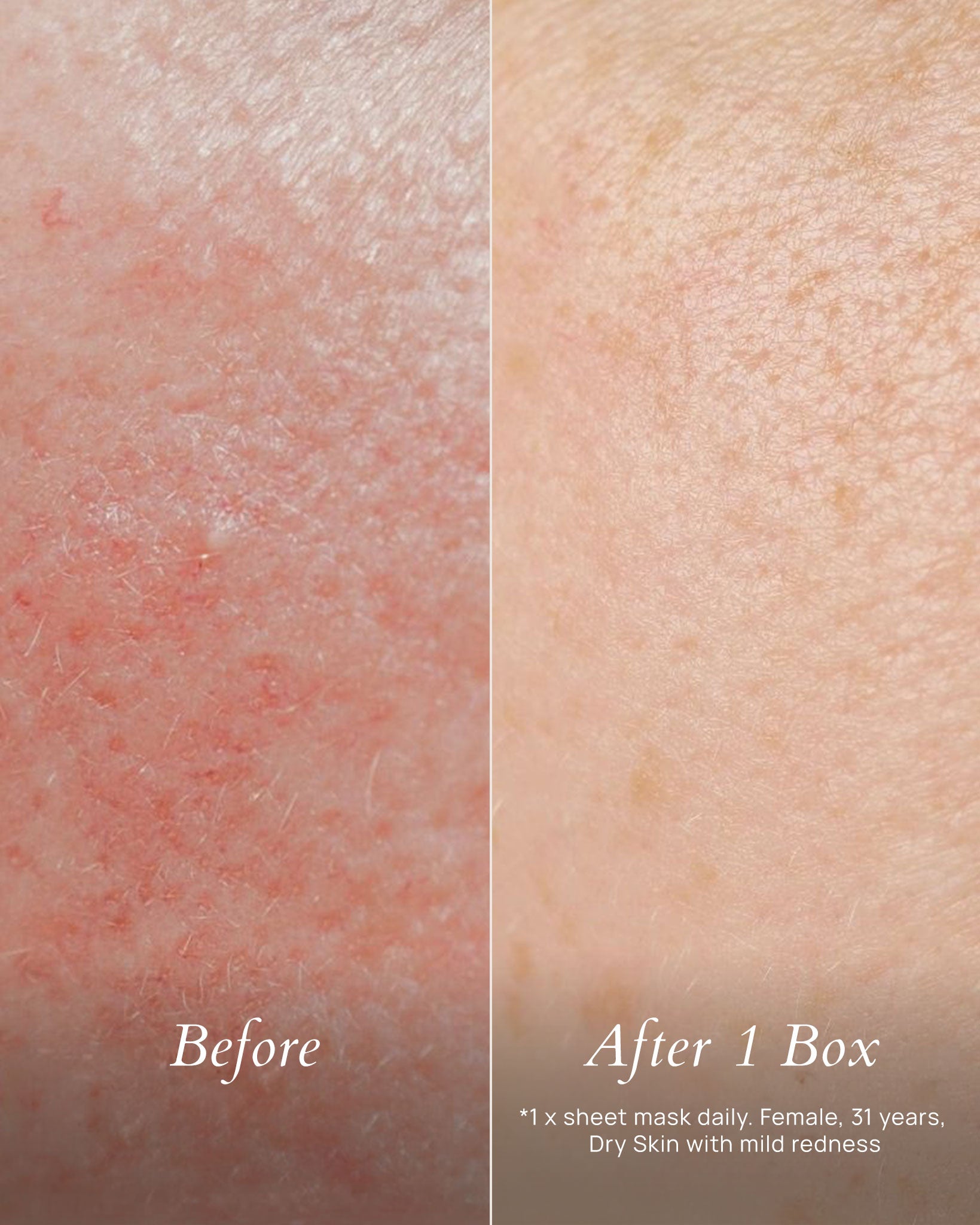 Sakura Smoothing Mask