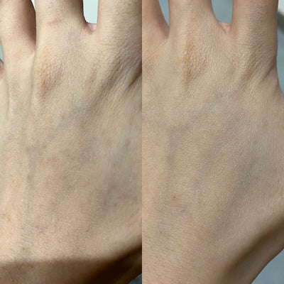 before and after snow fox skincare hand cream no more pigmentation and age spots