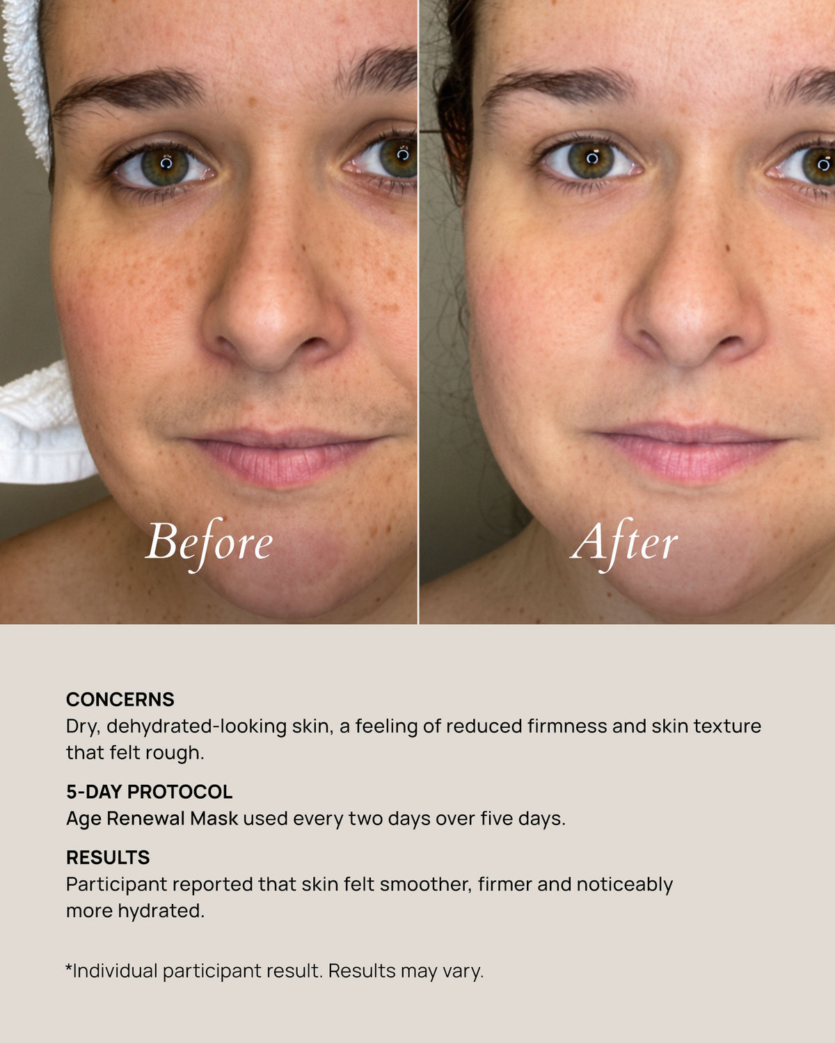 Age Renewal Mask