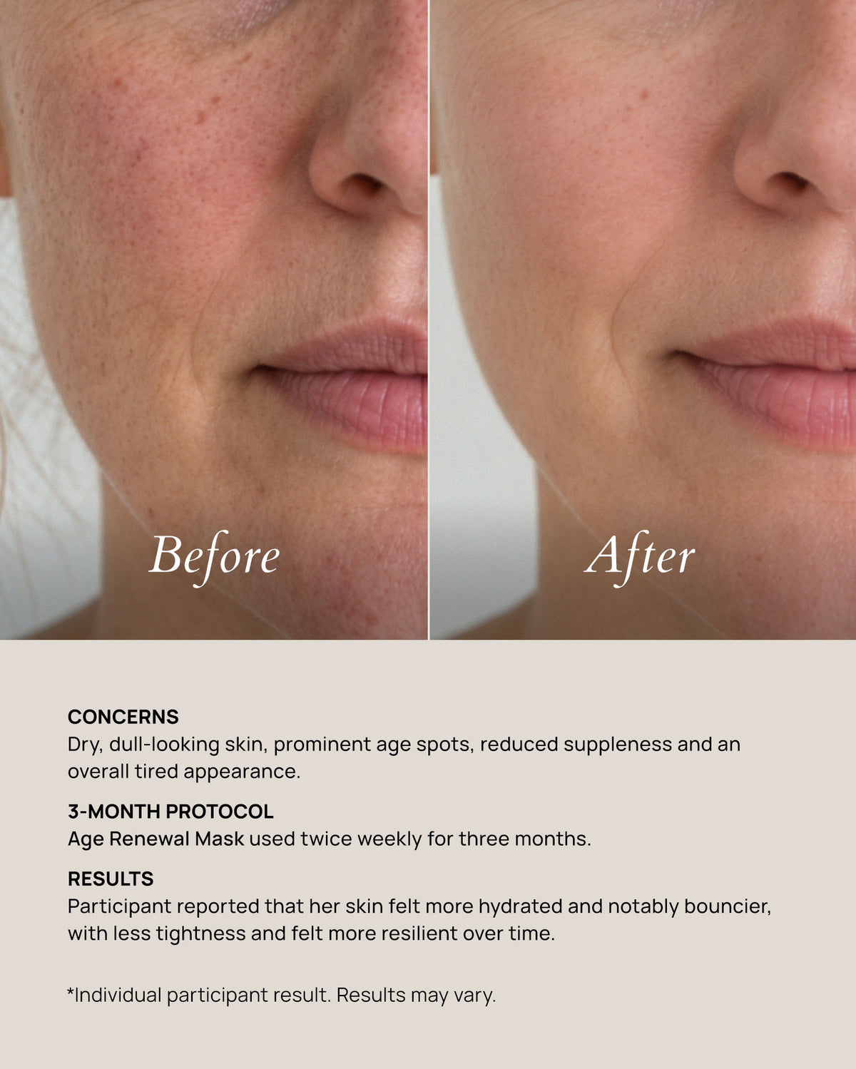 Age Renewal Mask