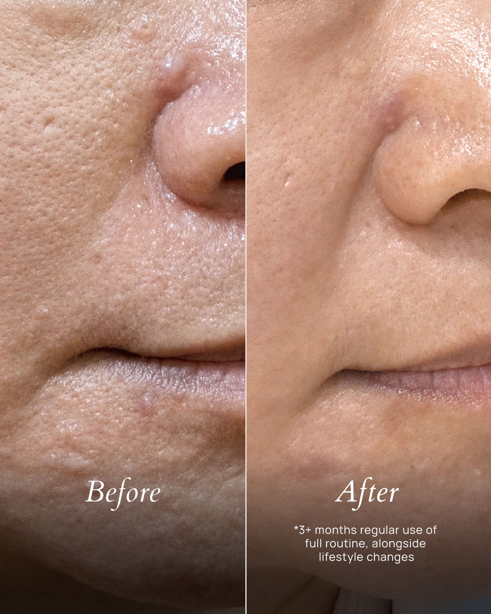 The Complete Arctic Rescue Skin Recovery System