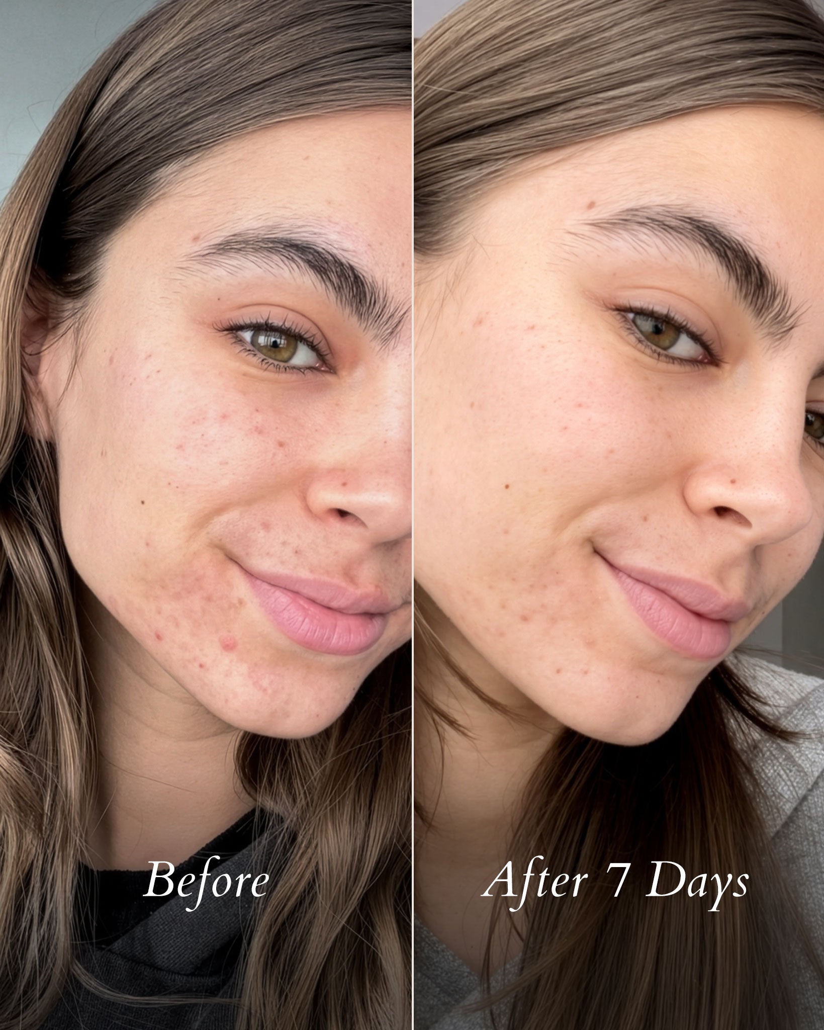 Luminizing Clarity Mask